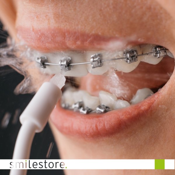SMST-Blog-Image-munddusche